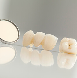 dental crown and bridge on a table