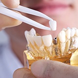 dentist placing a crown on top of a dental implant 