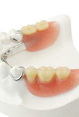 Partial denture on dental mold
